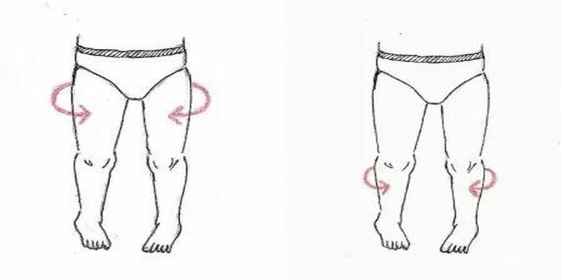8岁小孩走路内八字怎么纠正孩子走路内八