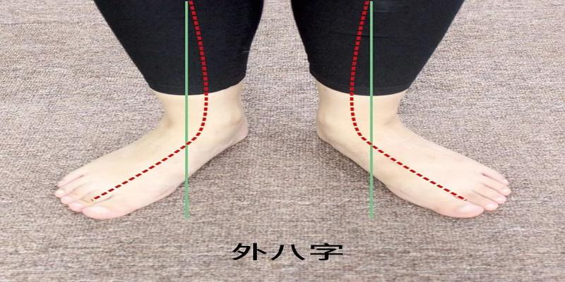 外八字走路图片(外八字走路图片女性)