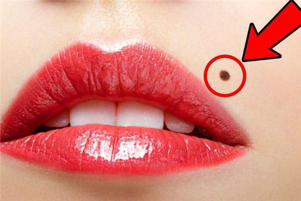 痣上长毛的运势解析痣上长毛好运连连